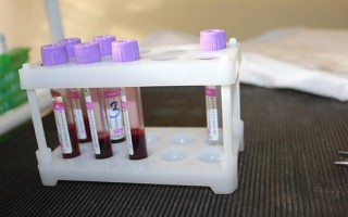 Биохимический анализ крови собаки: когда сдавать, что показывает норма, расшифровка отклонений
