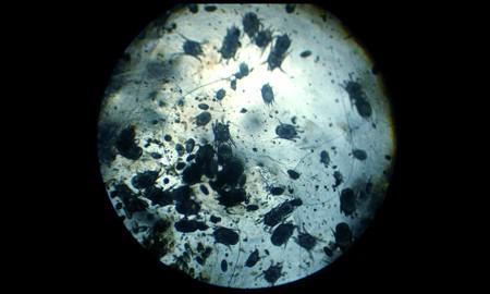 Отодектоз под микроскопом